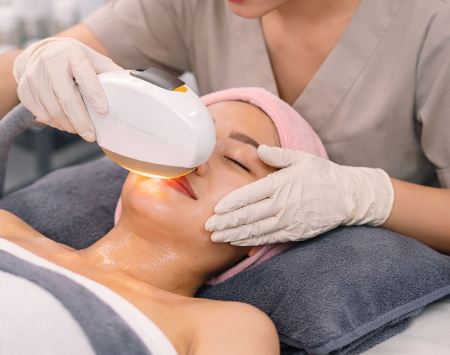 Triệt lông công nghệ IPL